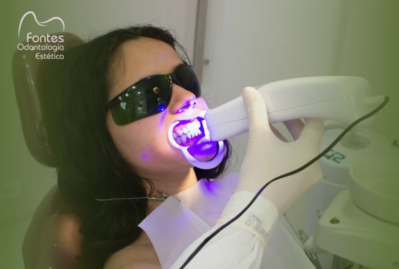 clareamento-dental-caseiro-vs-consultorio-ipanema