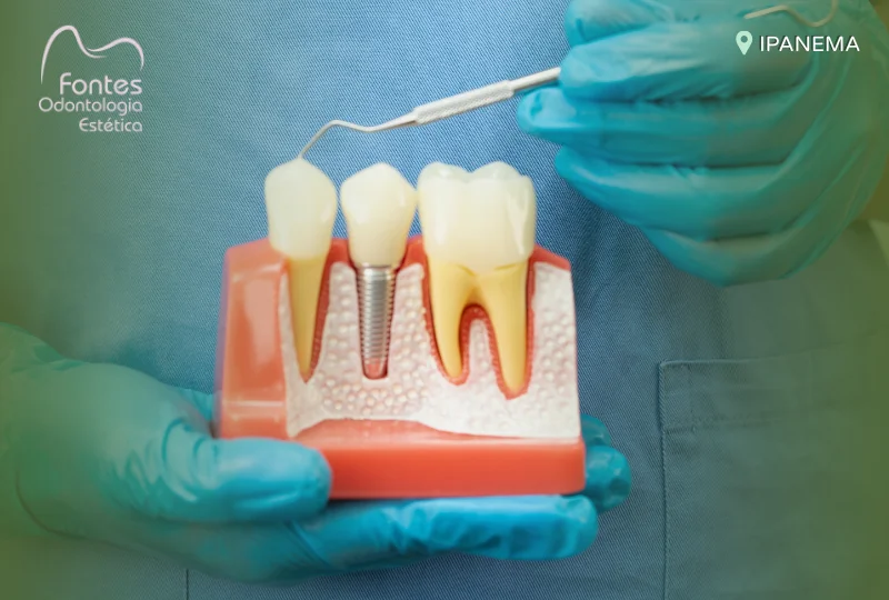 tecnicas implante dentario 01