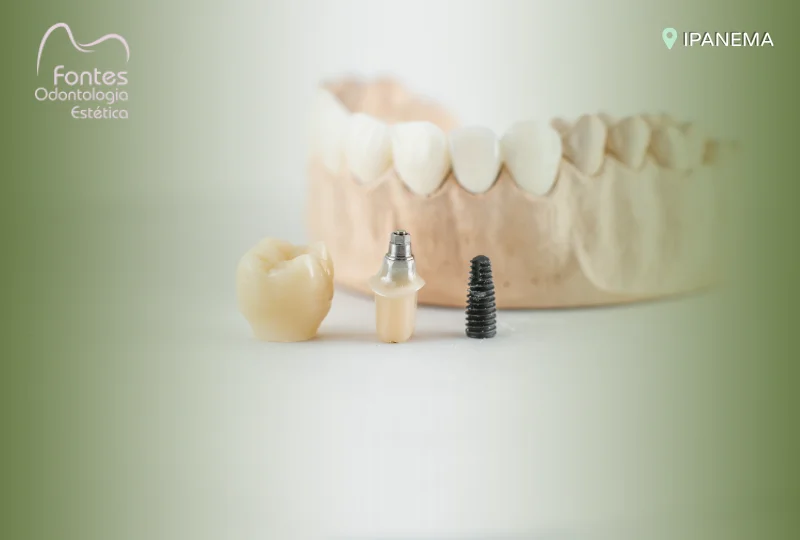 tipos implante dentario 01